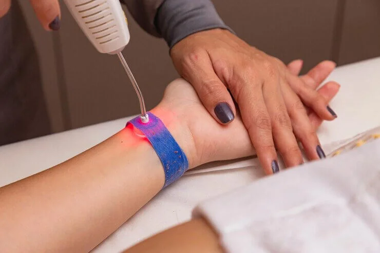 Aplicação do Ilib, laserterapia sistêmica, no punho